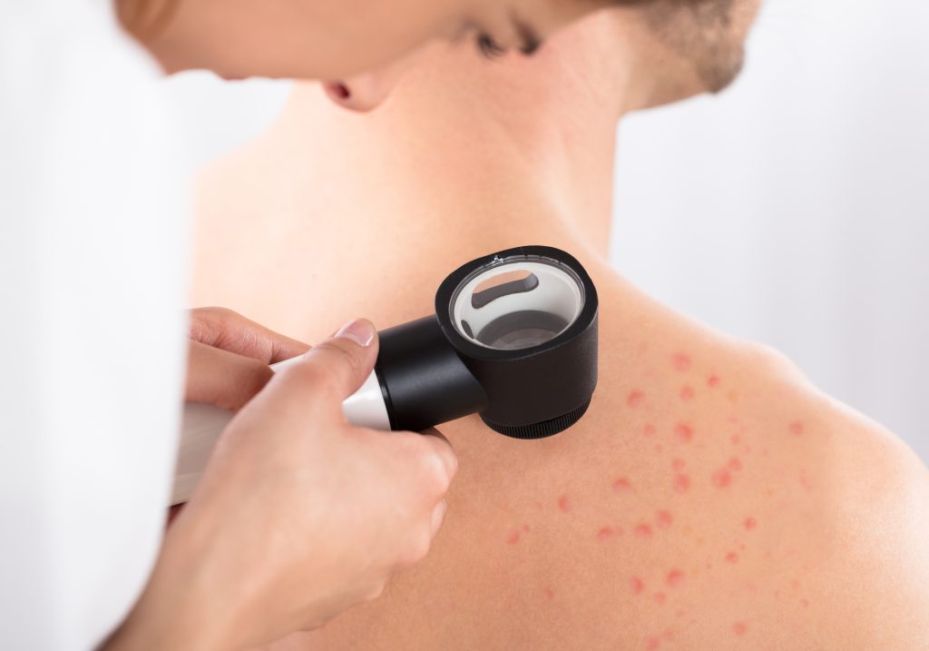 dermatolog, dermatolog poznań, konsultacja demratologiczna, badania krwi, centrum medyczne neoMedica