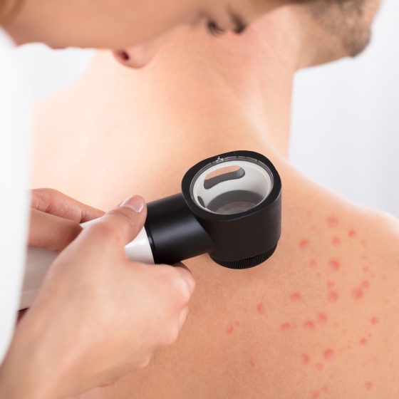 dermatolog, dermatolog poznań, konsultacja demratologiczna, badania krwi, centrum medyczne neoMedica