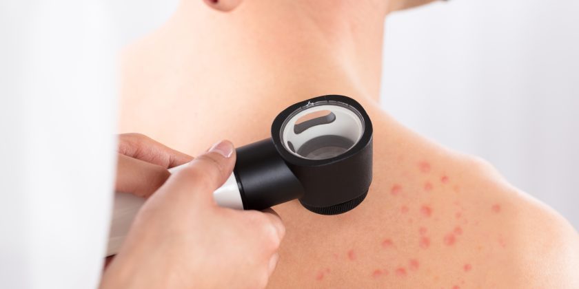 dermatolog, dermatolog poznań, konsultacja demratologiczna, badania krwi, centrum medyczne neoMedica