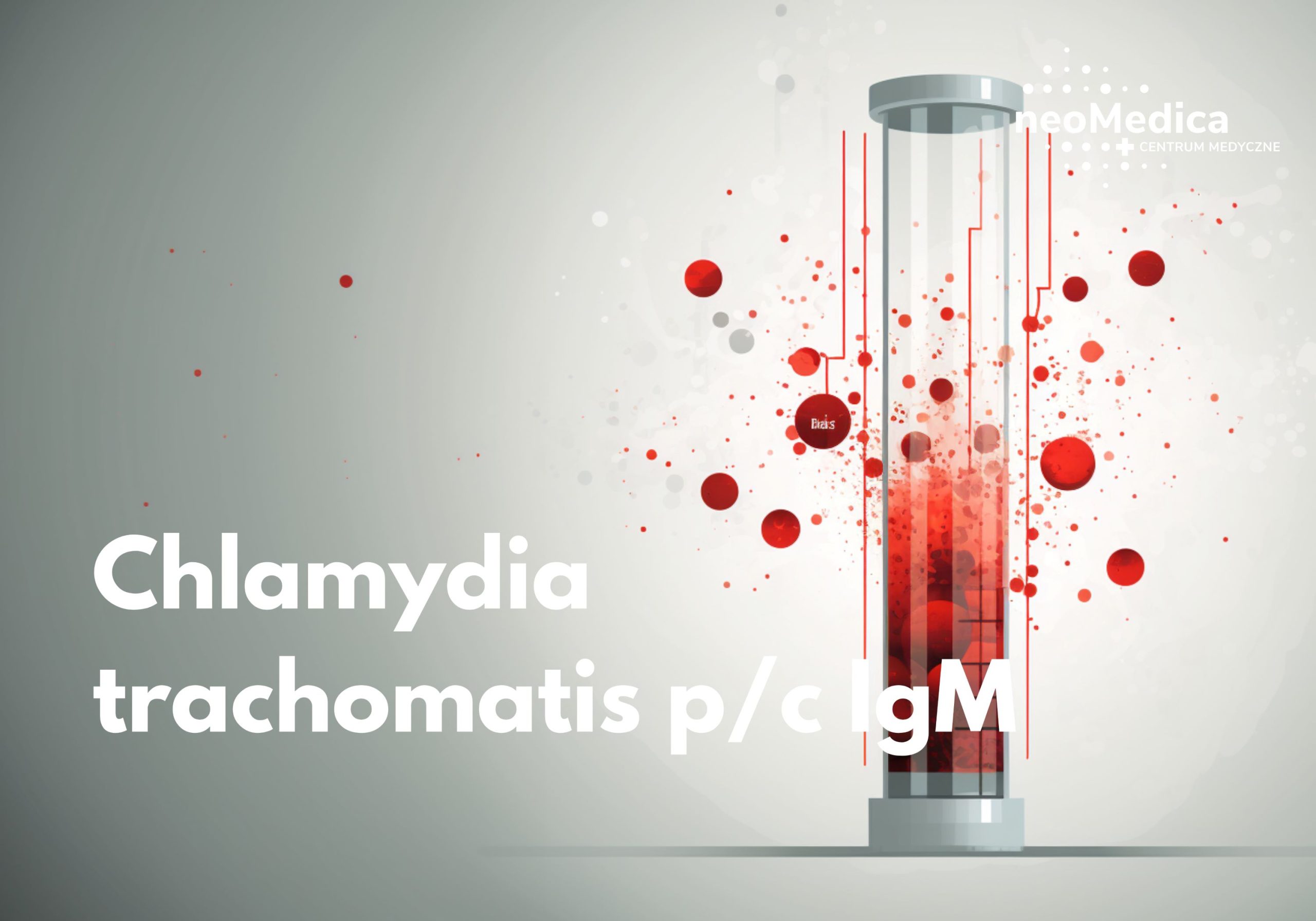 Badanie chlamydia trachomatis IgM Poznań | neoMedica | Kup online!