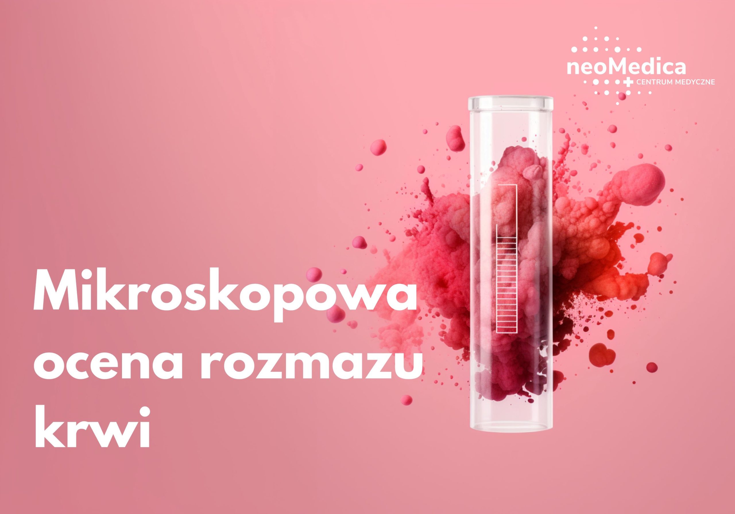 Rozmaz Nadaje Się Do Oceny Ale Występuje Znaczna Cytoliza
