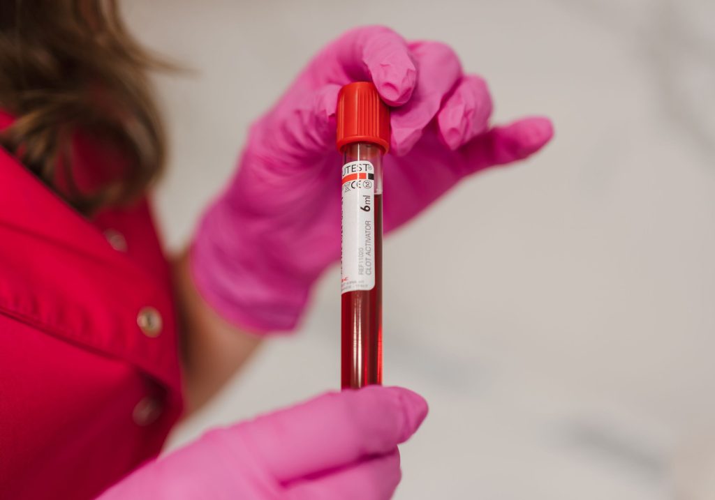 badania krwi, badania krwi Poznań, badania laboratoryjne, punkt pobrań, badania z krwi, Poznań
