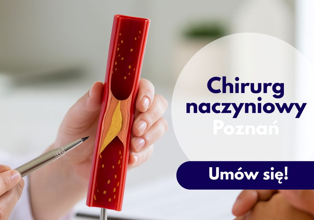Chirurg naczyniowy, USG doppler żył i tętnic, USG doppler, radiolog, USG chirurg naczyniowy, Poznań neoMedica