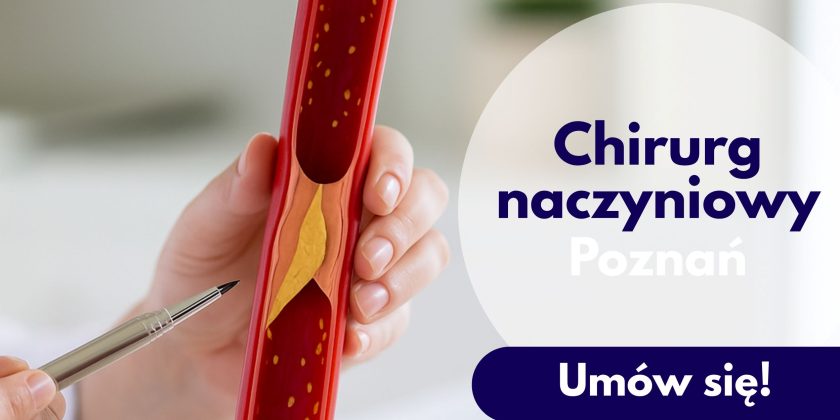 Chirurg naczyniowy, USG doppler żył i tętnic, USG doppler, radiolog, USG chirurg naczyniowy, Poznań neoMedica