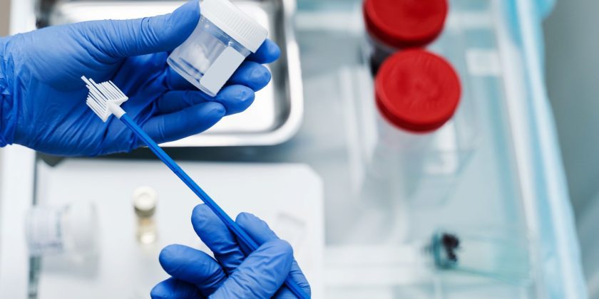 Położna Centrum Medycznego neoMedica w Poznaniu trzyma w rękawiczkach lekarskich szczoteczkę do cytologii płynnej, a w tle widoczne są zamazane pojemniki.