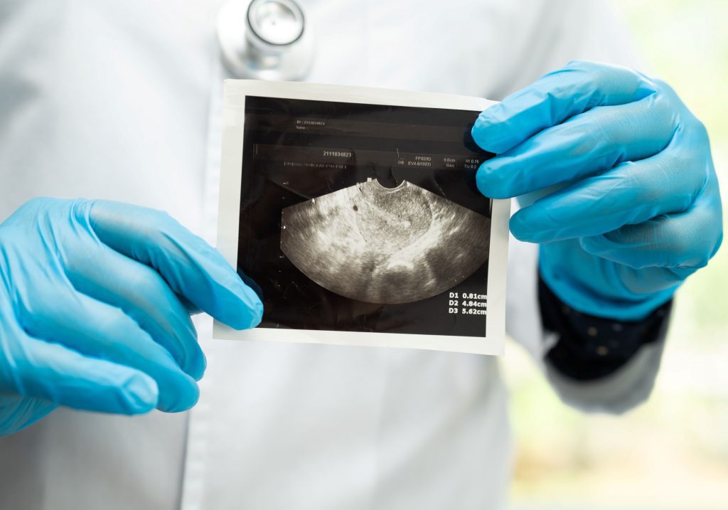 usg_uroginekologiczne_uroginekolog_poznan_neomedica_ginekolog