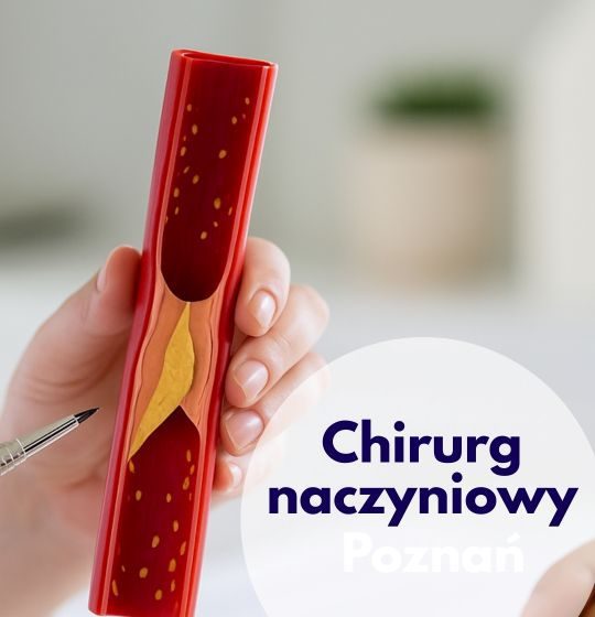 chirurg naczyniowy poznań, doppler tętnic i żył, wizyta u chirurga naczyniowego, usg doppler
