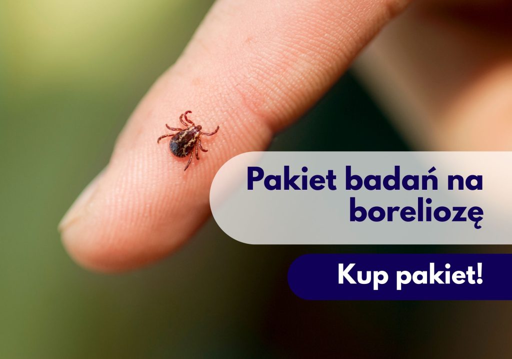badania krwi, badania krwi Poznań, badania laboratoryjne, punkt pobrań, badania z krwi, Poznań