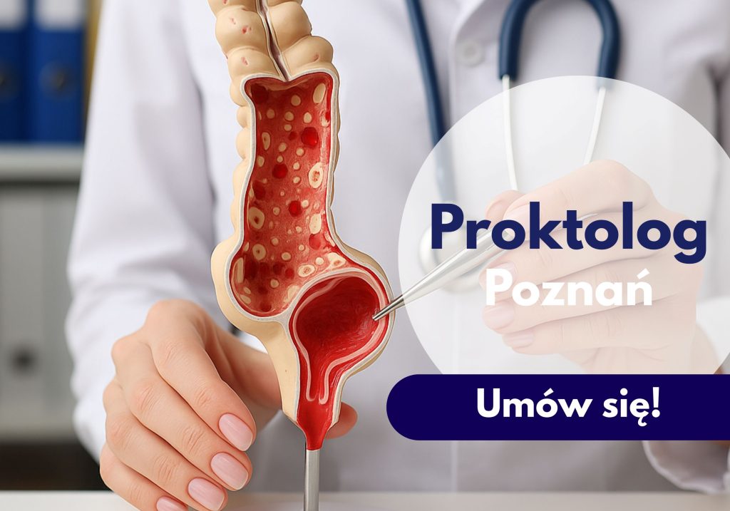 urolog poznań, badanie USG, konsultacja urologiczna, proktolog poznań, neomedica