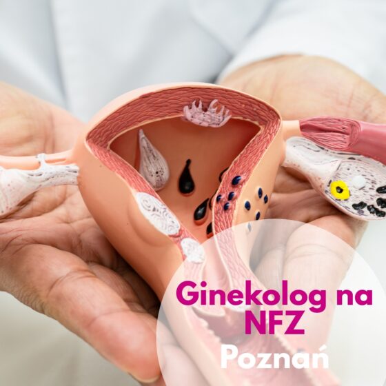 Model narządu macicy trzymany przez lekarza ginekologa na NFZ w Centrum Medycznym neoMedica w Poznaniu.